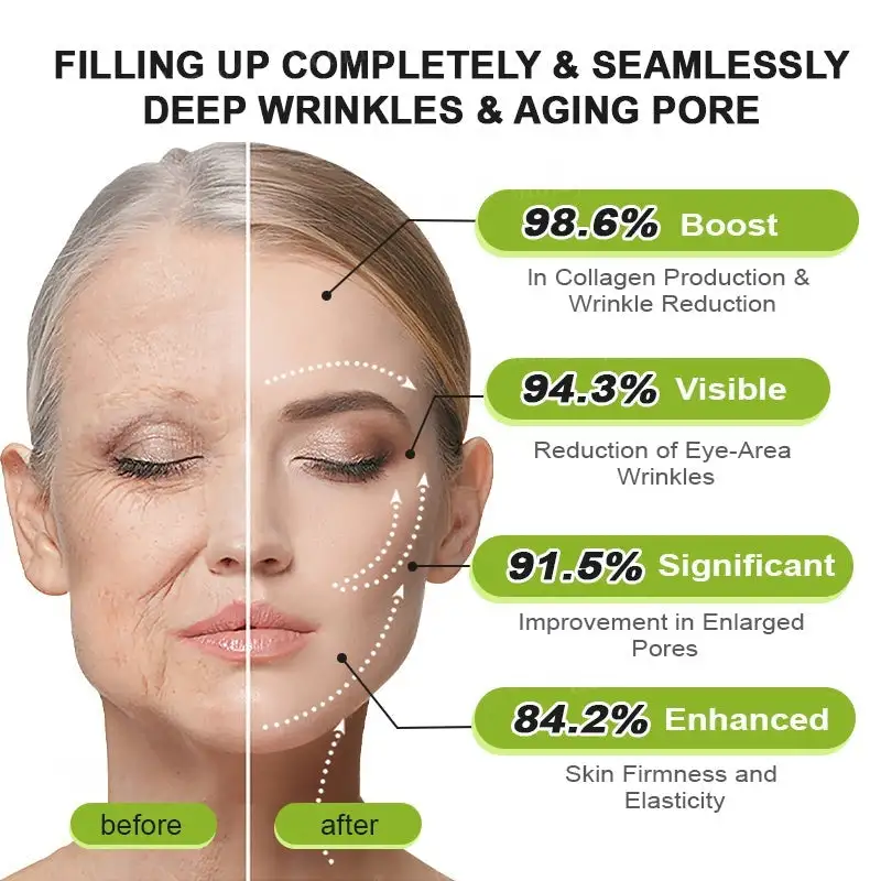 Botox & Vita-A Retinol Shot Wrinkle-Lift Tightening cream - Image 22