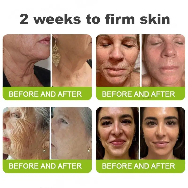 Botox & Vita-A Retinol Shot Wrinkle-Lift Tightening cream - Image 8