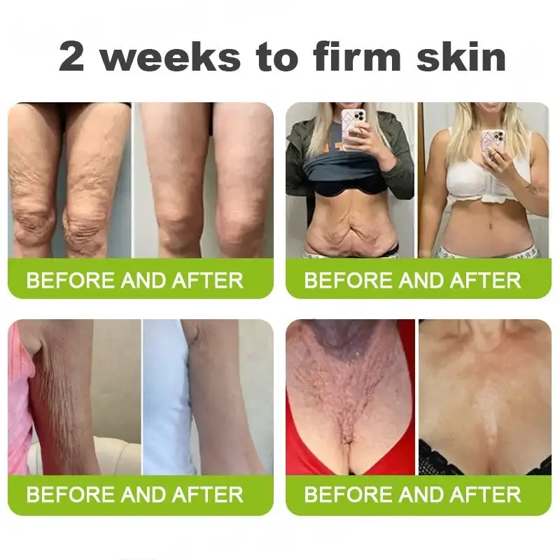 Botox & Vita-A Retinol Shot Wrinkle-Lift Tightening cream - Image 9