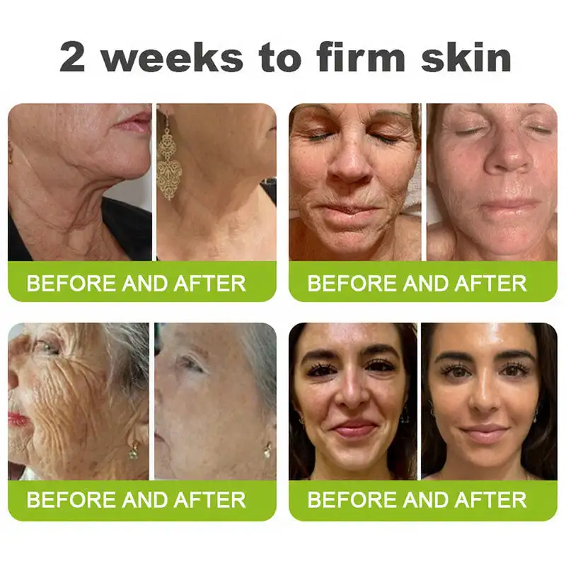 🧠👨⚕️Made and shipped from the USA 💫 Skin Tightening & Vita-A Retinol Retinol shot Anti-Wrinkle Firming Tightening cream - Image 7