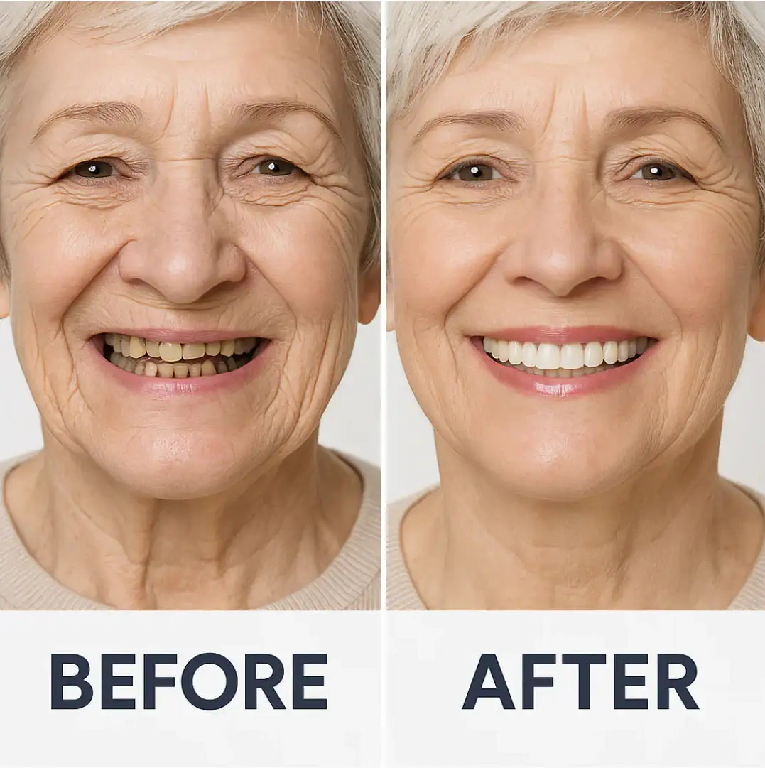 Custom-Fit Functional Dentures Smile with Confidence - Image 5