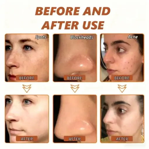 Whitening and Spot-Removing Face Mask Suitable for face and body - Image 11