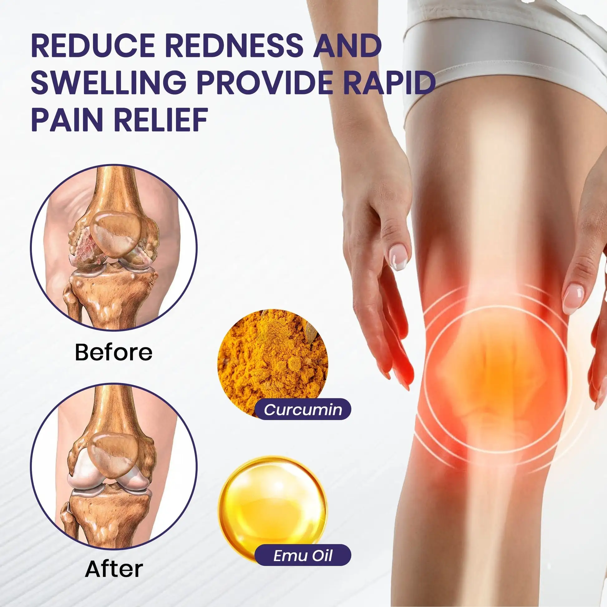 Turmeric & Emu Oil Arthritis Soothing Pain Relief Massage Gel - Image 5