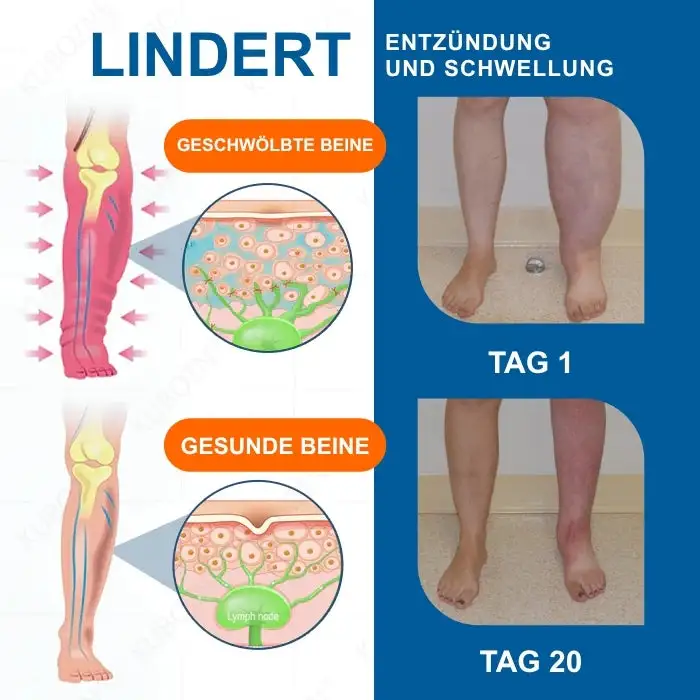 Offizieller Store | Holen Sie sich das Gefühl von Leichtigkeit in 7 Tagen zurück! LYMPHÖDEM-Drainage-Massagecreme - Image 3