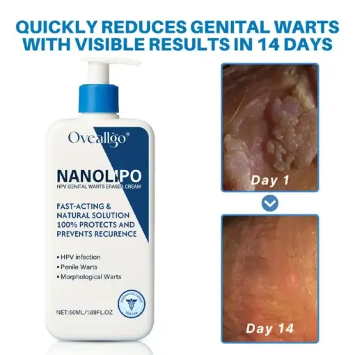NanoLipo HPV Genital Warts Eraser Cream Ultra - Image 2