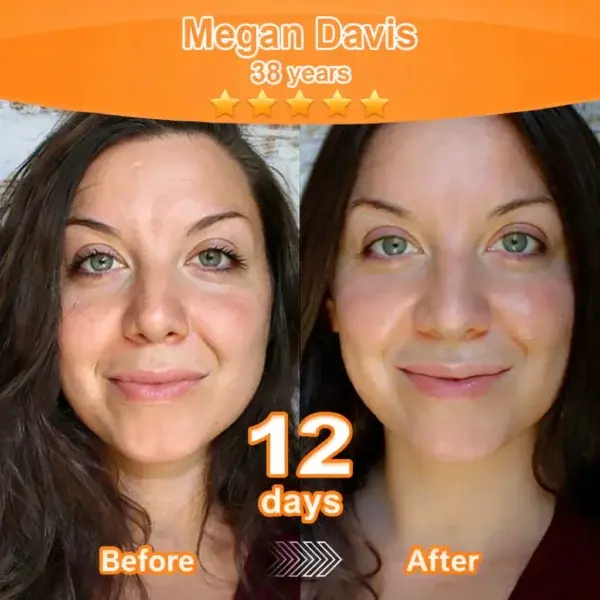 Stem Cell–Derived EGF & Copper Peptide Revitalising Essence Cream - Image 8