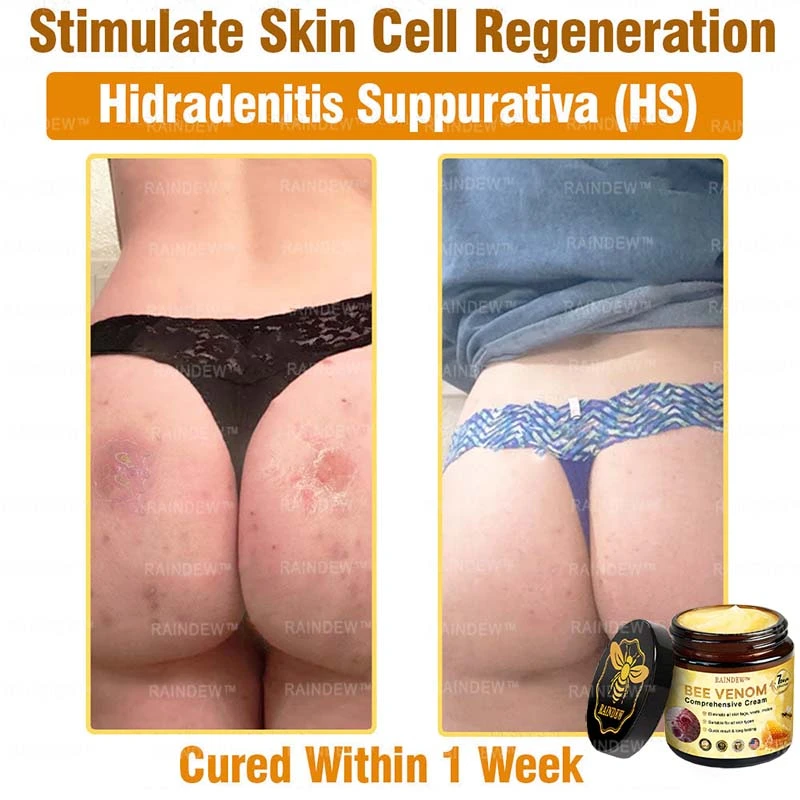 Bee Venom Comprehensive Cream - Image 10