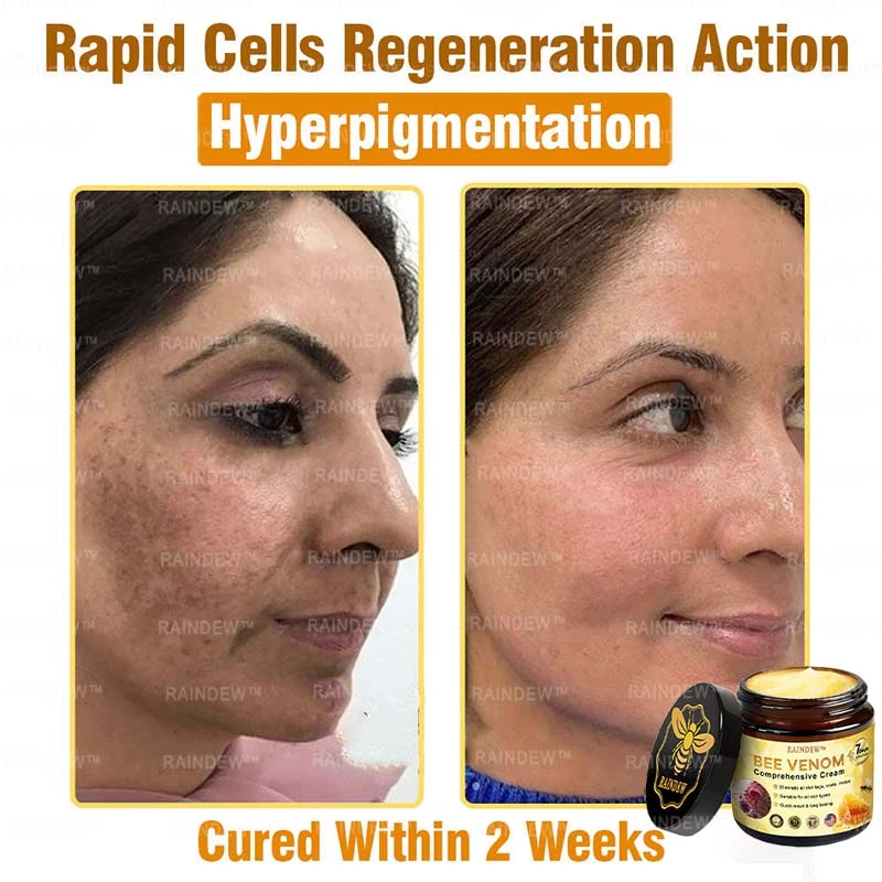 Bee Venom Comprehensive Cream - Image 9