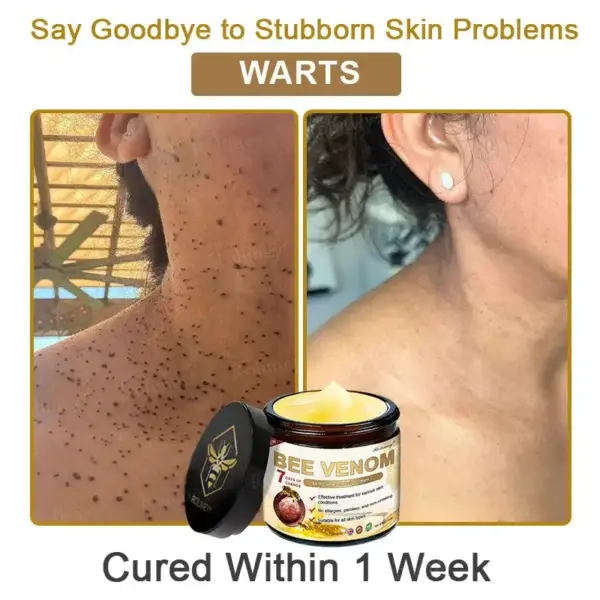 Botox Bee Venom Skin Treatment Cream - Image 10