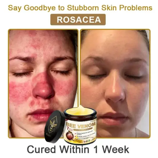 Botox Bee Venom Skin Treatment Cream - Image 7