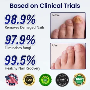 Alternative view of Anti-Fungal Nail Repair Patch