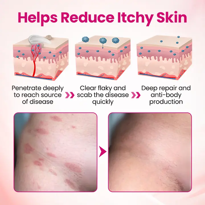 IntiDefend Anti-HPV Interferon Gel - Image 10