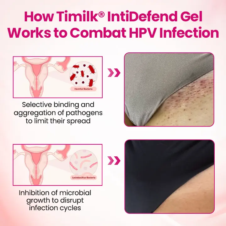 IntiDefend Anti-HPV Interferon Gel - Image 3