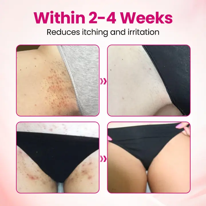 IntiDefend Anti-HPV Interferon Gel - Image 4