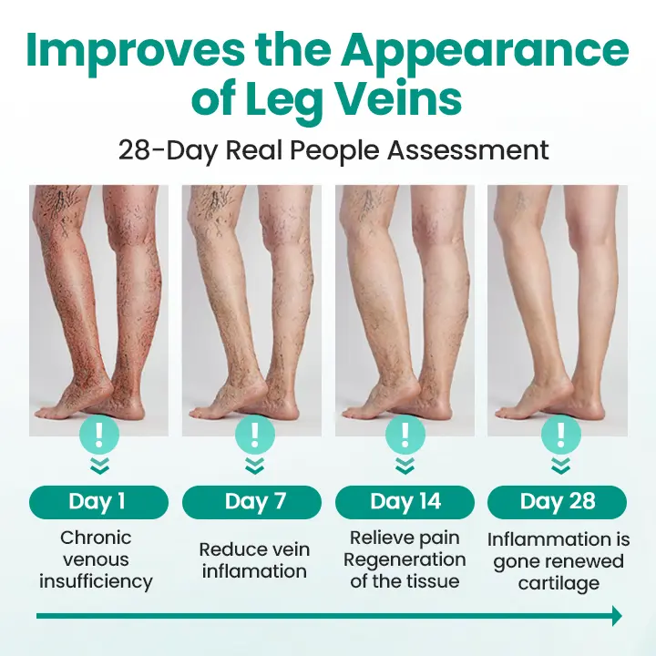 LegRenew Varicose Veins Patch - Image 3