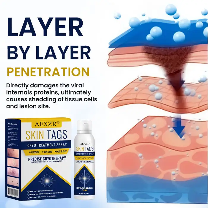Warts No More - 50% OFF | Skin Tag Cryo Treatment Spray - Image 4