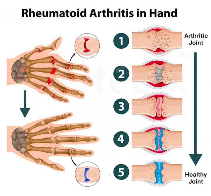 Advanced Joint & Bone Therapy Bee Venom Gel - Image 3