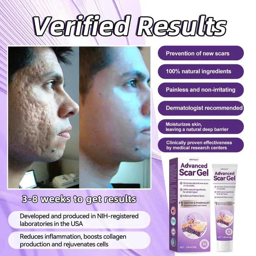 Advanced Scar Gel - Image 2