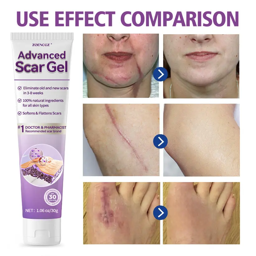 Advanced Scar Gel - Image 4
