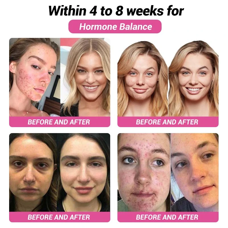 Vaginal Natural Moisturizing Repair Gel - Image 7