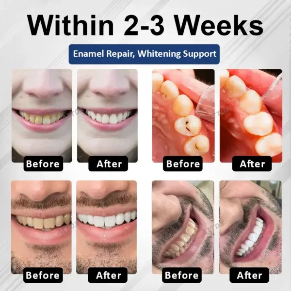 BioEnamel Biomimetic Tooth Armor Drops - Image 4