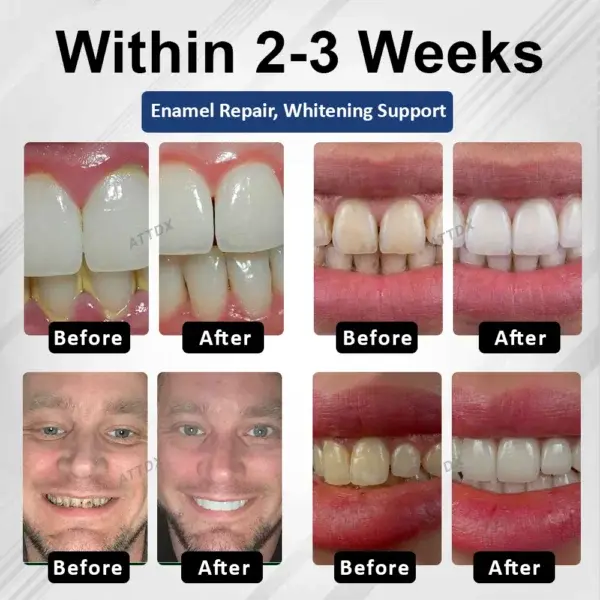 BioEnamel Biomimetic Tooth Armor Drops - Image 5