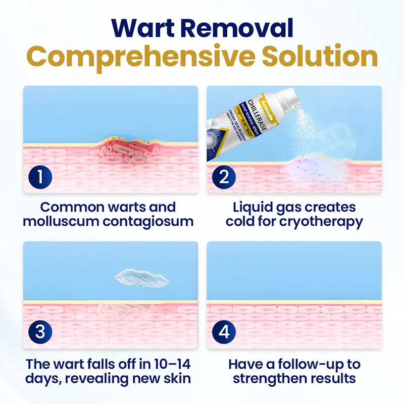 ChillErase Bump Renewal Spray - Image 2