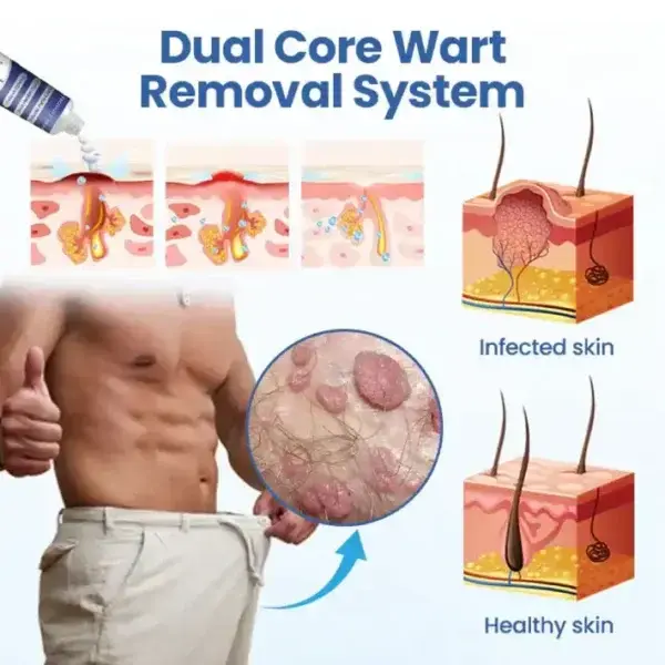 WartRelief Cream - Image 2