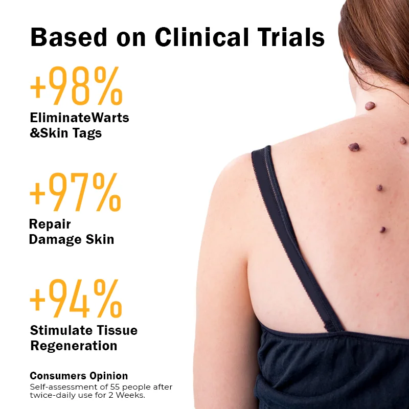 FlawlessFix Mole & Wart Removal Cream - Image 2