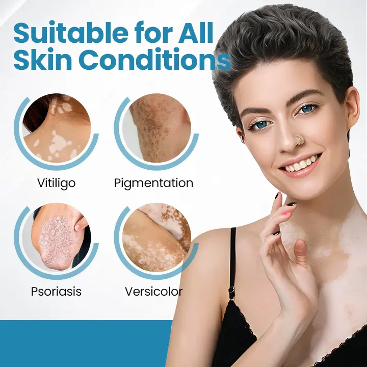 DermaBeam Vitiligo Therapy Device - Image 7