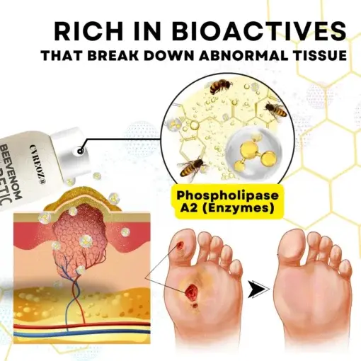 Bee Venom Diabetic Foot Healing Spray - Image 7
