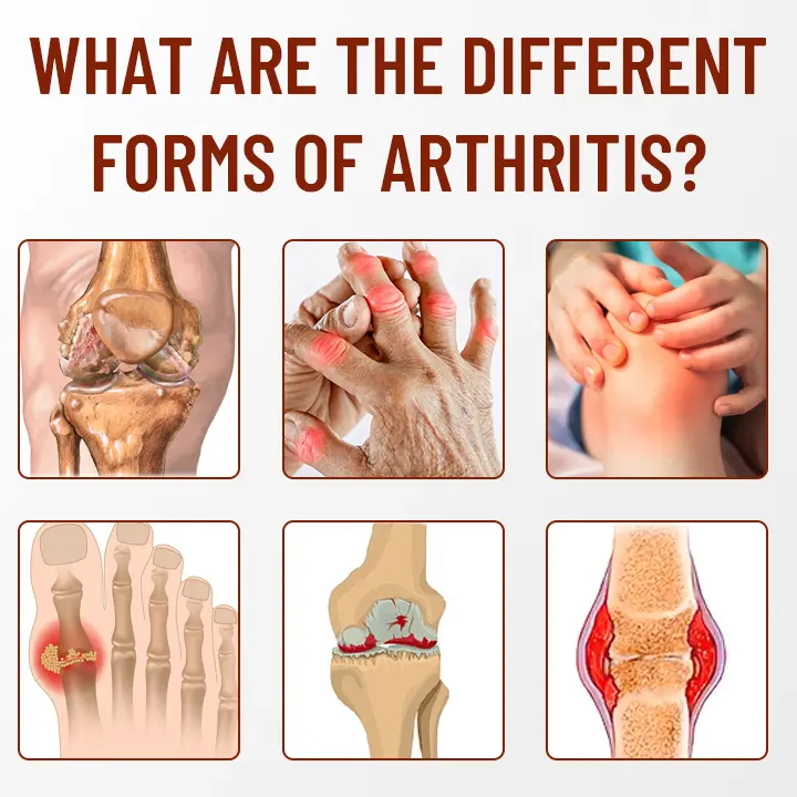 Bone Soothing Turmeric Therapy Spray - Image 2