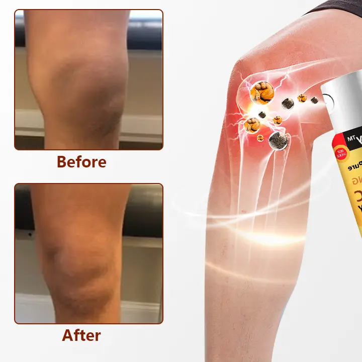 Bone Soothing Turmeric Therapy Spray - Image 3