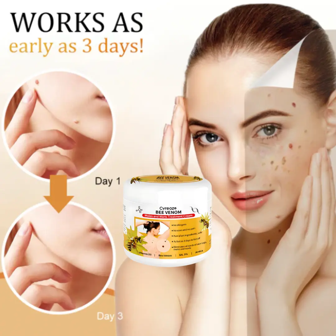 Bee Venom Mole and Wart Treatment Cream - LIMITED-TIME OFFER - Image 14
