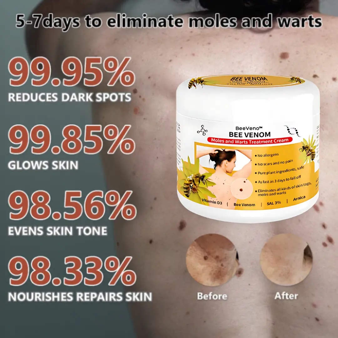 Bee Venom Mole and Wart Treatment Cream - LIMITED-TIME OFFER - Image 2