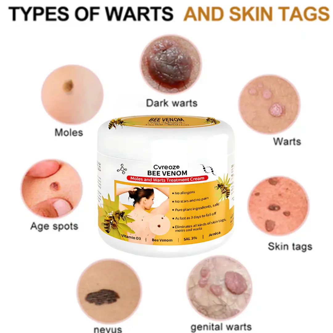 Bee Venom Mole and Wart Treatment Cream - LIMITED-TIME OFFER - Image 4