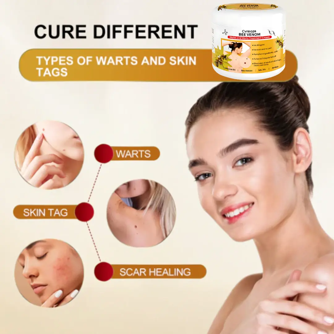 Bee Venom Mole and Wart Treatment Cream - LIMITED-TIME OFFER - Image 5