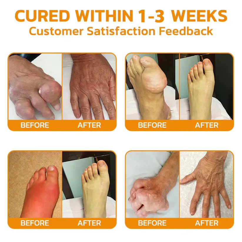 Bienengift Creme gegen Muskel- und Gelenkschmerzen - Image 2