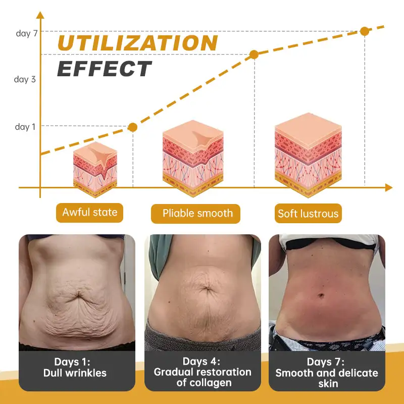 Botox Bee Venom Wrinkle Firming Multi-Purpose Cream - Image 7