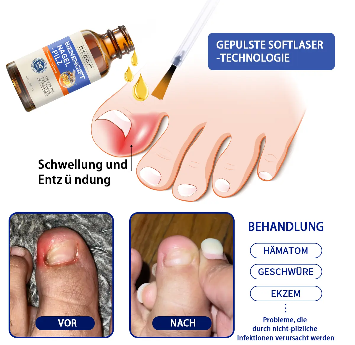 Bee Venom Nail Fungus Treatment Solution - Image 4