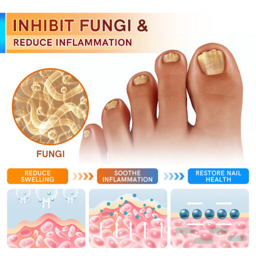 PsoriaCare Psoriasis Treatment Cream - Image 4