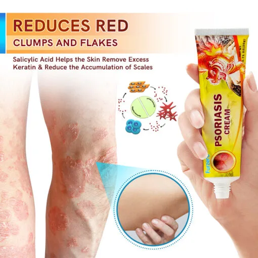 PsoriaCare Psoriasis Treatment Cream - Image 5