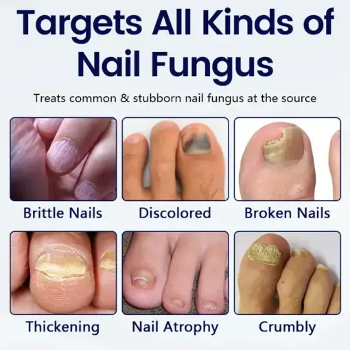 Anti-Fungal Nail Repair Patch - Image 3