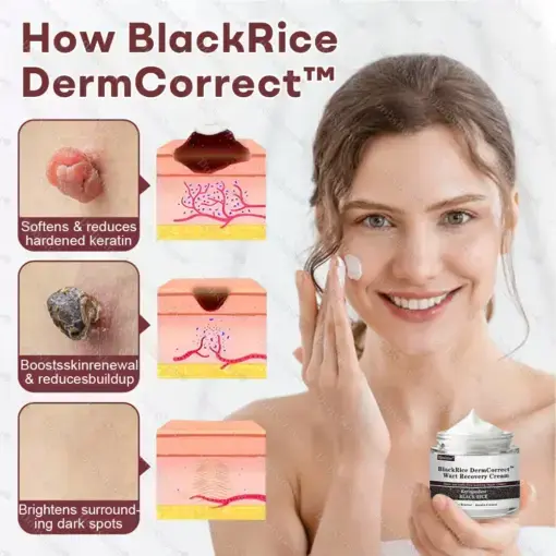 BlackRice Wart Recovery Cream Suitable for all skin types - Image 2