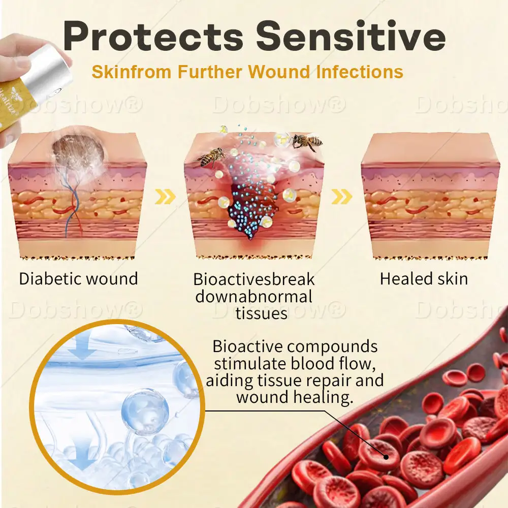 ⭐ 𝘽𝙚𝙨𝙩 𝙎𝙚𝙡𝙡𝙚𝙧 | GlucoShield Bee Venom Wound Spray - Image 4