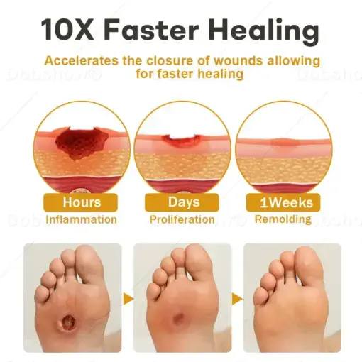 GlucoShield Bee Venom Wound Spray1 Best-Selling Wound Care Spray - Image 6