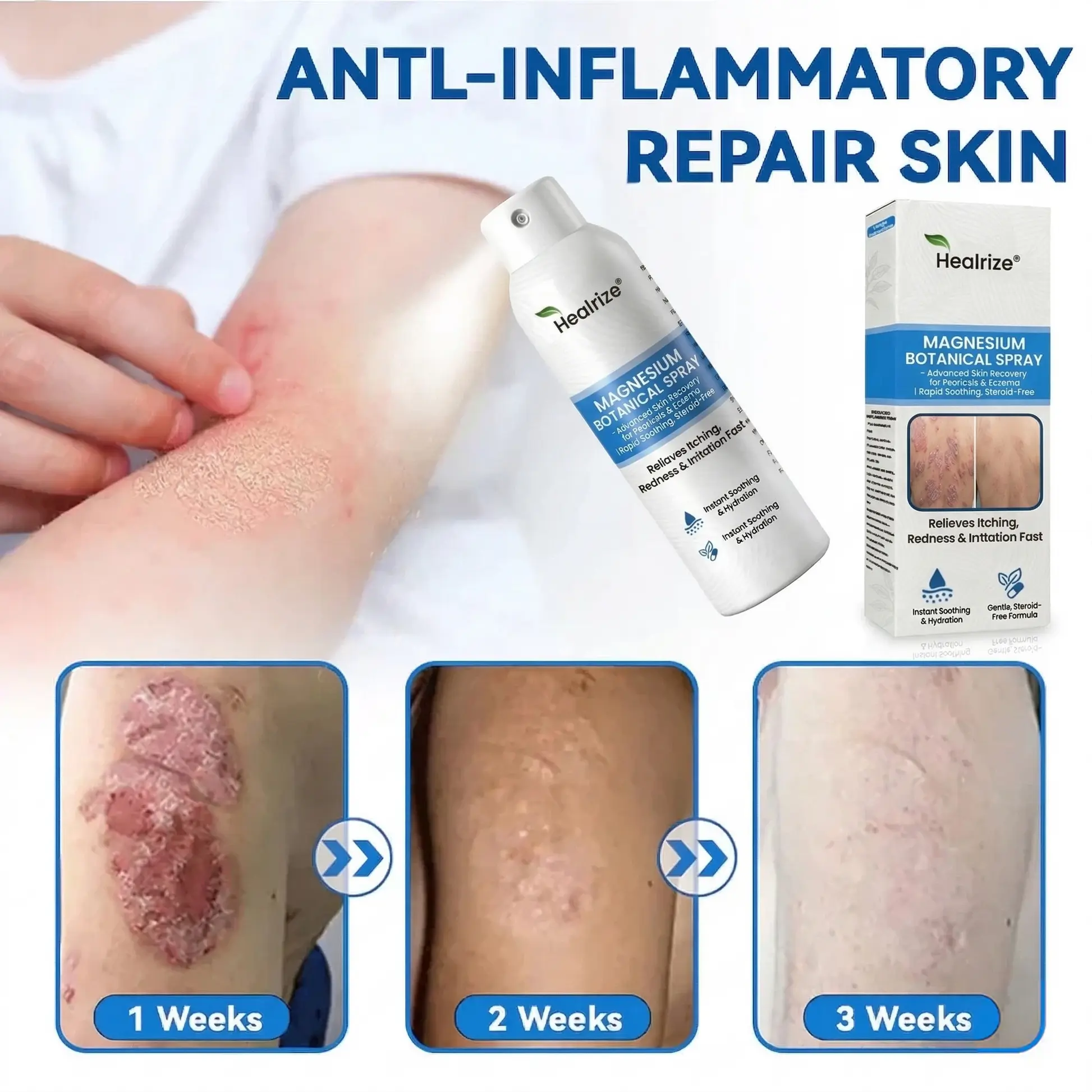 Magnesium Botanical Spray – Advanced Skin Recovery for Psoriasis & Eczema - Image 3
