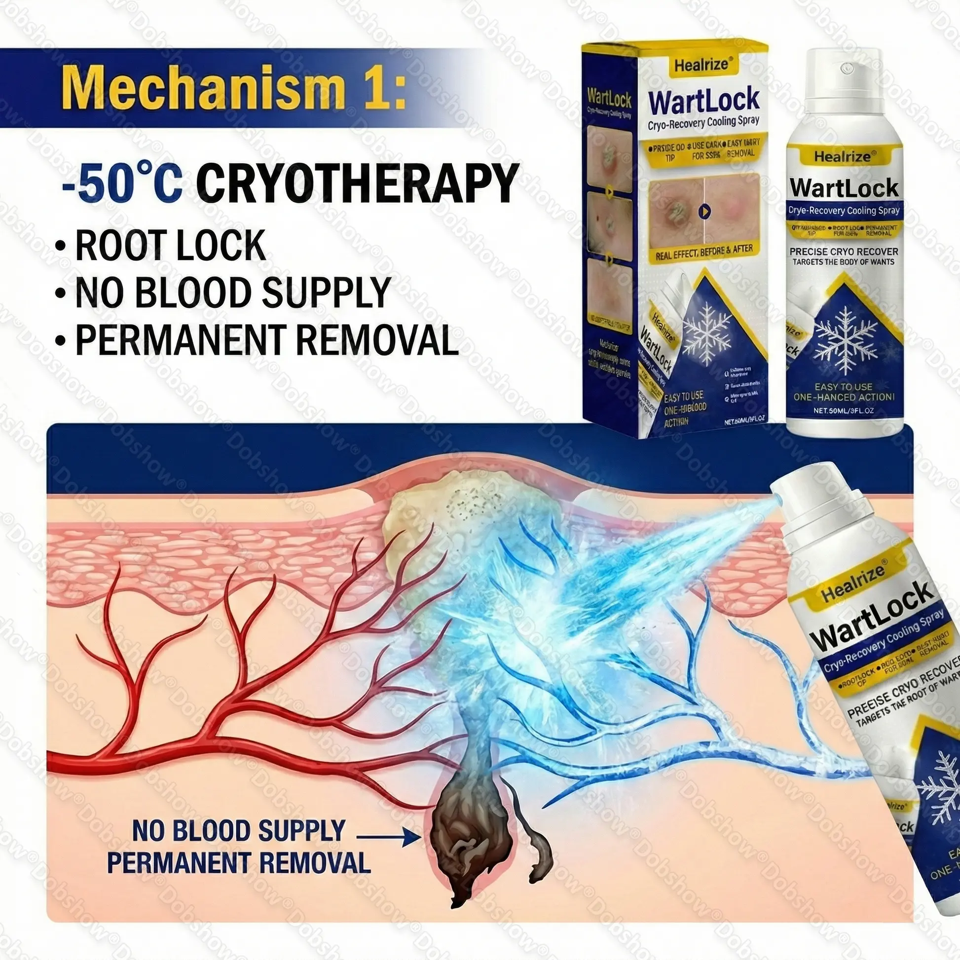 ๐ฅ๐๐๐ง๐๐ ๐๐ฅ๐๐๐๐๐ก ๐๐๐๐๐ง๐จ | WartLock Cryo-Recovery Cooling Spray - Image 2