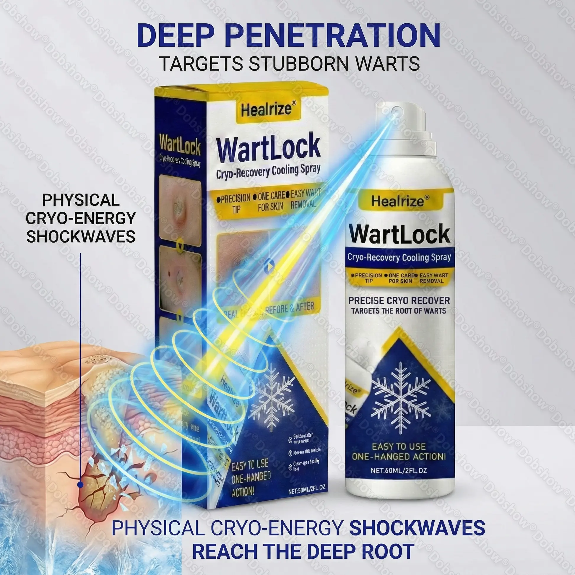 ๐ฅ๐๐๐ง๐๐ ๐๐ฅ๐๐๐๐๐ก ๐๐๐๐๐ง๐จ | WartLock Cryo-Recovery Cooling Spray - Image 5