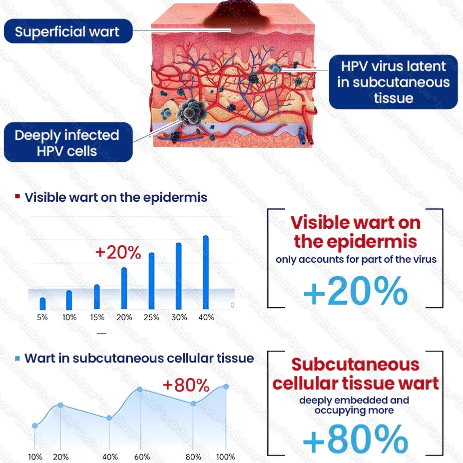 ๐ฅ๐๐๐ง๐๐ ๐๐ฅ๐๐๐๐๐ก ๐๐๐๐๐ง๐จ | WartLock Cryo-Recovery Cooling Spray - Image 7